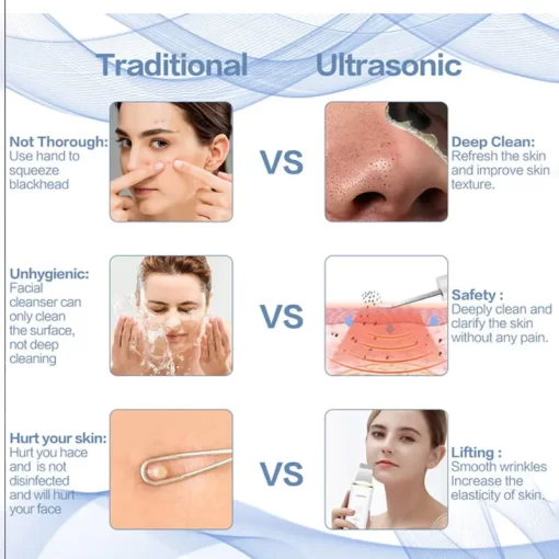 Eternistore® Ultrasonic Facial Skin Scrubber