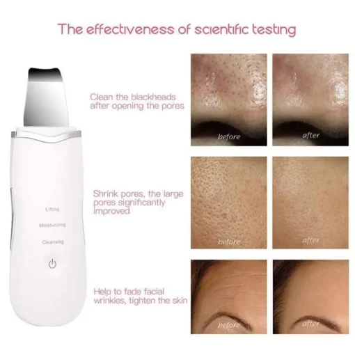 Eternistore® Ultrasonic Facial Skin Scrubber