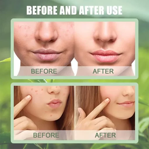 Eternistore® The Magic Green Stick Mask